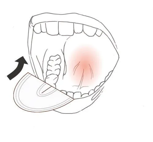 Drydent Parotid tvář vel. L 50 ks