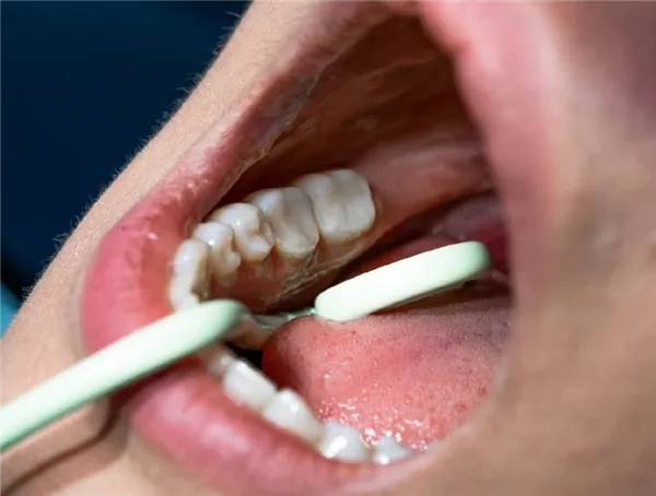 Savky spirálové Hygoformic BIO - 100 ks zelené