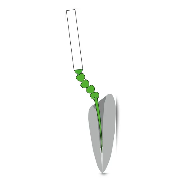 Surgitip Endo ISO 60 (0,35mm) 20ks