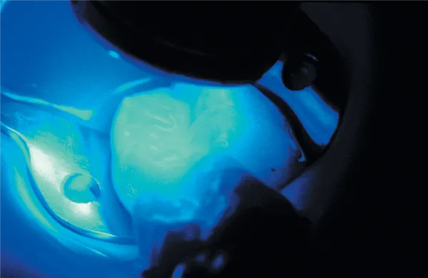 UltraSeal XT Plus A1 4 x 1,2 ml