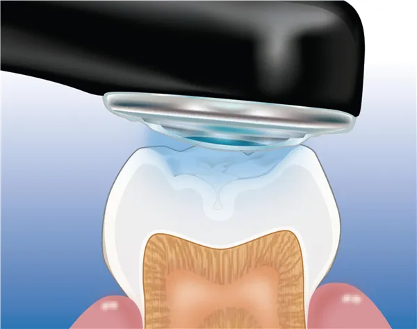 UltraSeal XT Hydro kit natural