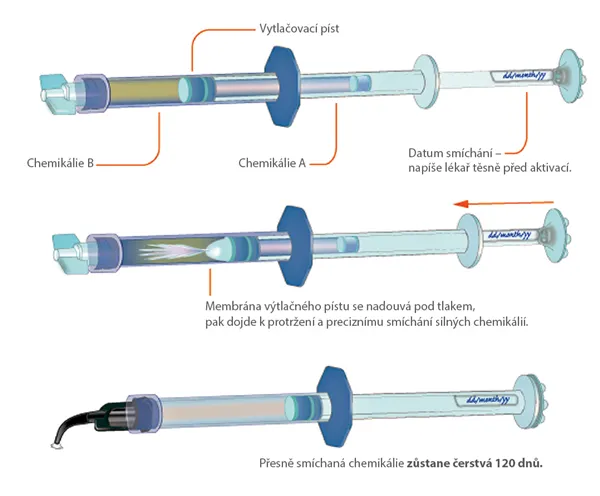 Peak Universal Bond 4 x 1,2 ml