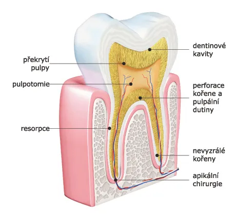 Biodentine 15 x 0,7 g