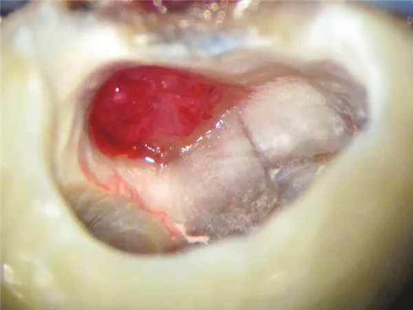 Biodentine 15 x 0,7 g