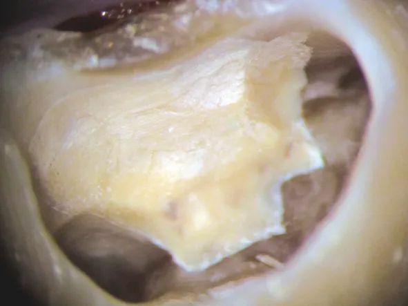Biodentine 15 x 0,7 g