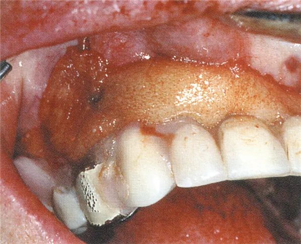 Reso-Pac, 50 x 2 g
