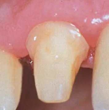 Comprecap Anatomic č.3 (M) 120 ks