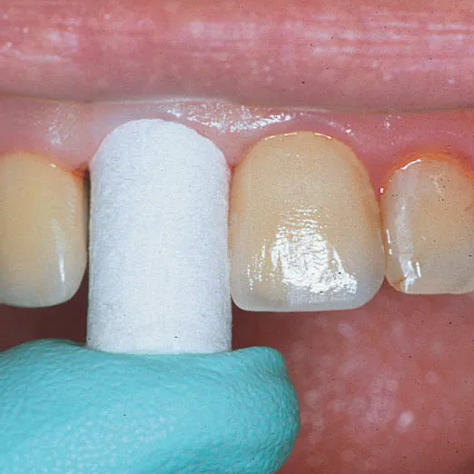 Comprecap Anatomic č.3 (M) 120 ks