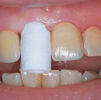Comprecap Anatomic č.3 (M) 120 ks