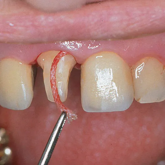 Comprecap Anatomic č.3 (M) 120 ks