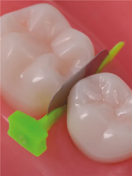 FenderPrimary krátké 18 ks - neon. žluté