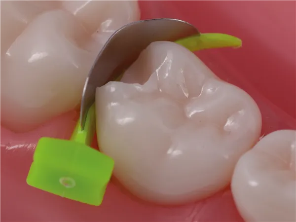 FenderPrimary krátké 18 ks - neon. žluté