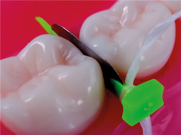 FenderPrimary krátké 18 ks - neon. žluté
