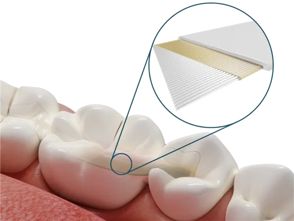 Dentapreg PFU 3ks (2x0,3x60mm)