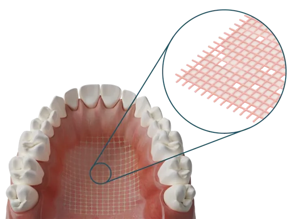 Dentapreg síťka Mesh Pink 1ks (60x80x0,5mm)
