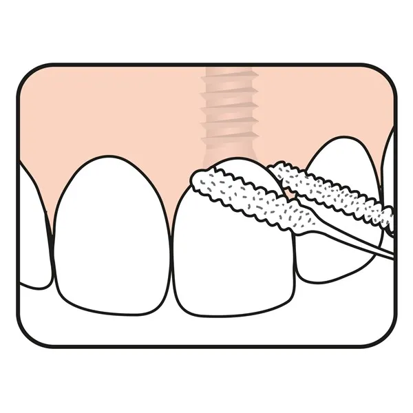 TePe Bridge & Implant zubní nit